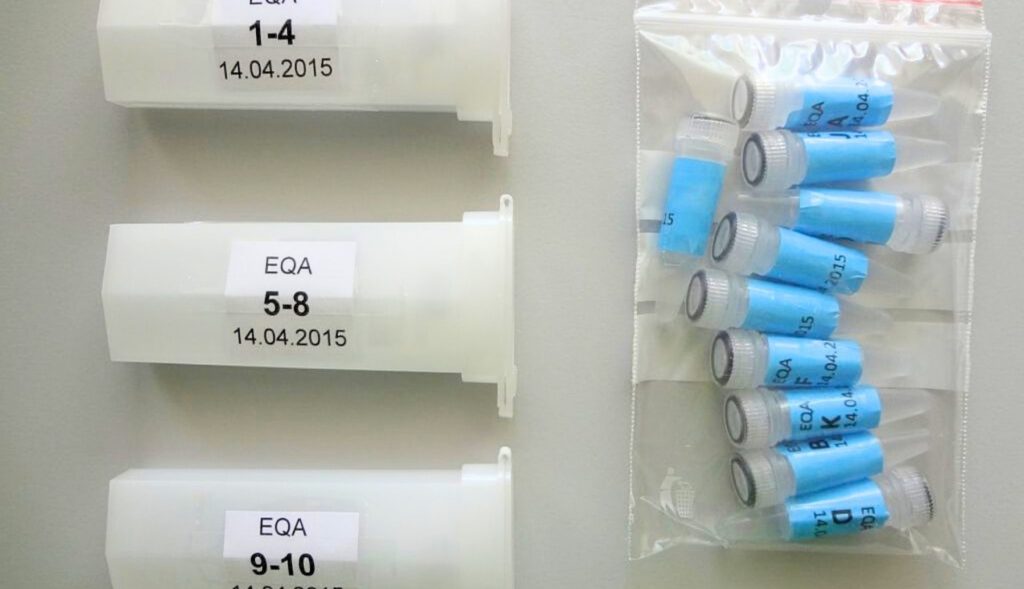 EQA Program on TB diagnosis capacities in Belgium, Estonia, Latvia, Lithuania, Moldova, Peru, South Africa